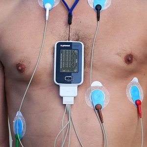Holter Monitoring: Apakah sama dengan Elektrokardiogram (EKG)?
